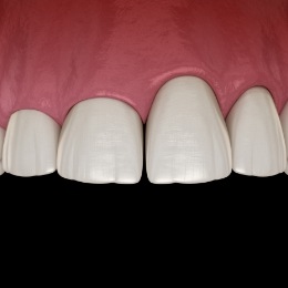 Illustrated row of teeth with an uneven gumline