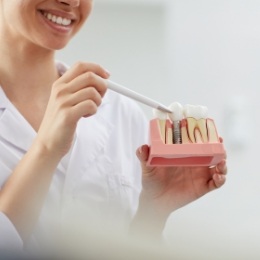 Dentist showing a model of a dental implant to a patient