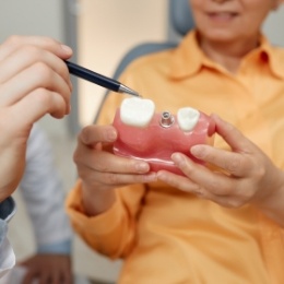 Dentist showing a dental implant model to a patient