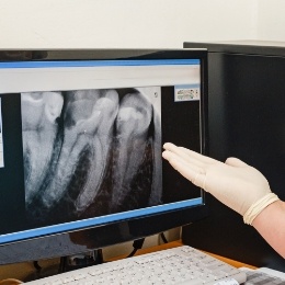 Gloved hand gesturing to computer monitor showing digital x rays of teeth